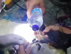 Jari Bengkak Parah Akibat Cincin Nyangkut, BPBD Tangerang Beraksi di RS: Warganet Heboh, Salut Banget!