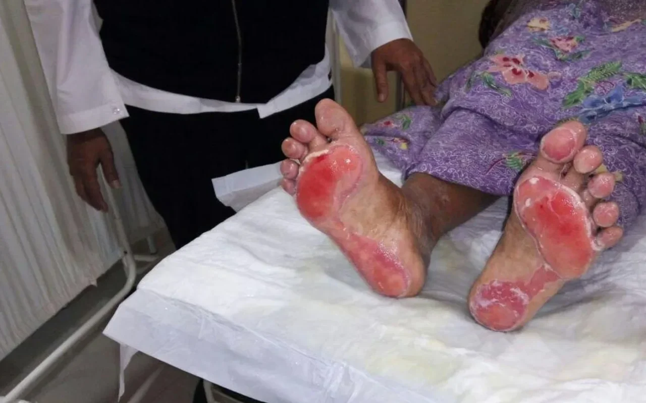 Kaki Melepuh Parah! Legenda Nasi Bebek Singapura Ini Terpaksa Tutup Sebulan, Ada Apa?