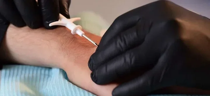 Swedia Geger! Ribuan Warga Tanam Microchip di Tubuh, Praktis atau Ngeri Banget?